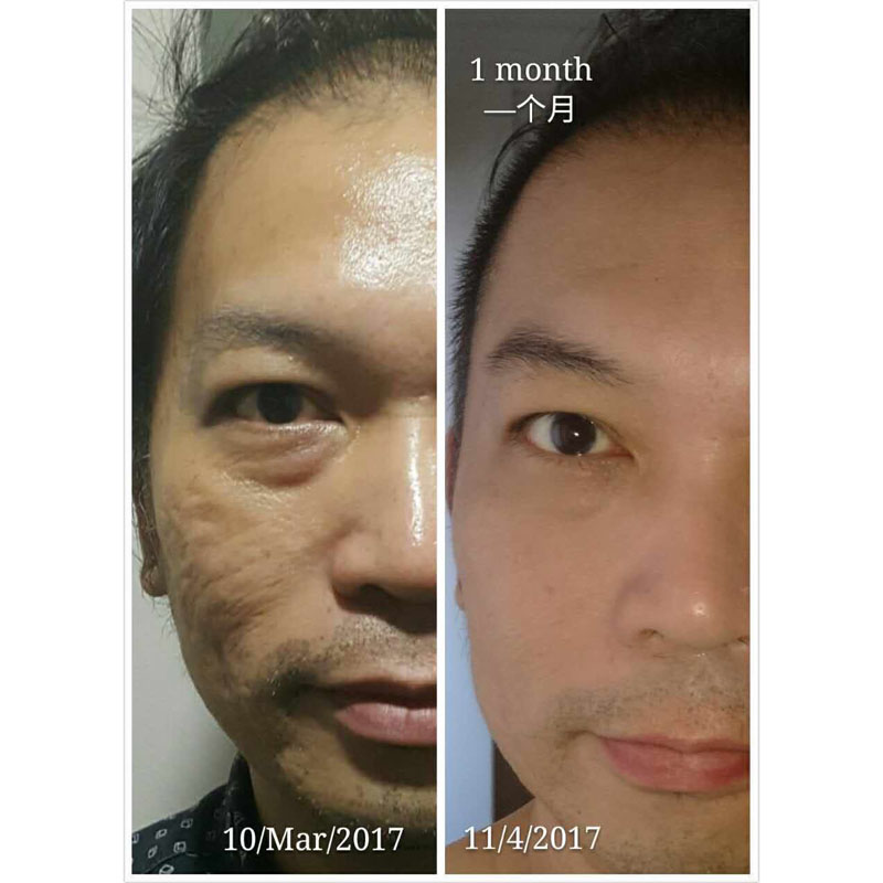 before after picture