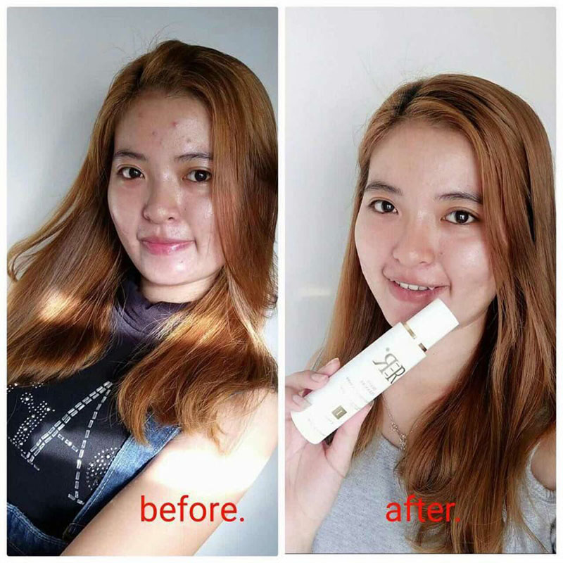 before after picture