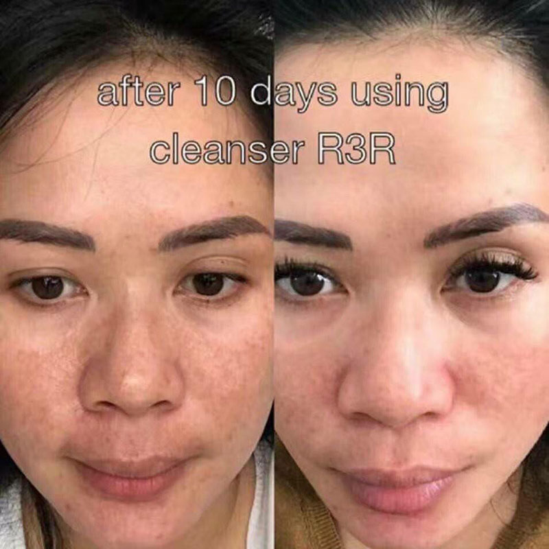before after picture
