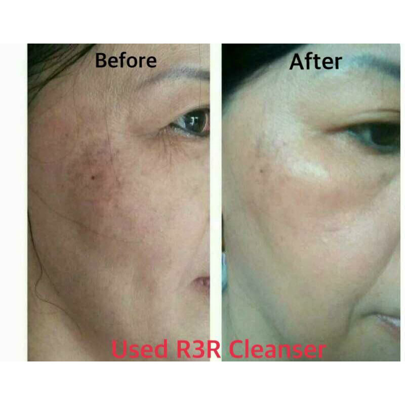before after picture