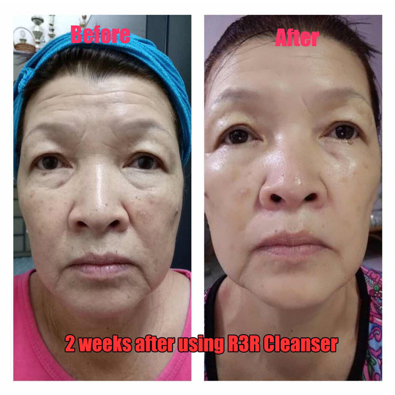 before after picture